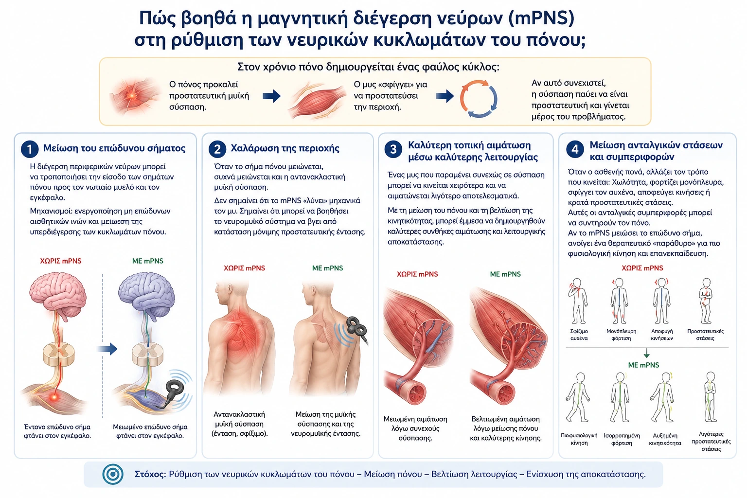 Πώς βοηθά η μαγνητική διέγερση νεύρων (mPNS) στη ρύθμιση των νευρικών κυκλωμάτων του πόνου;